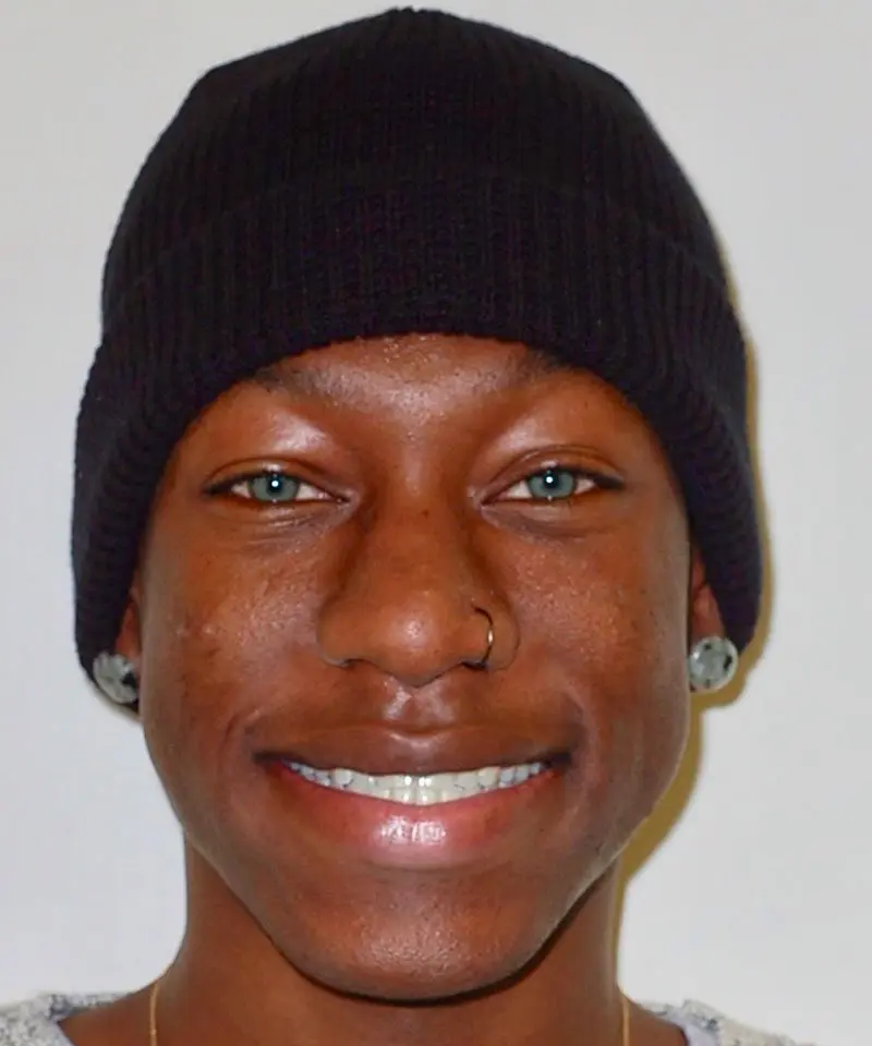 Man smiling showing her teeth - Smilebliss