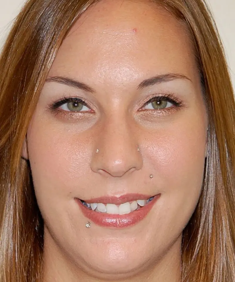 A woman's face smiling - Smilebliss