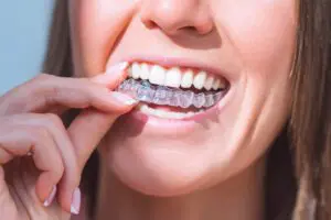 Woman with perfect smile wearing invisible dental aligners for dental correction