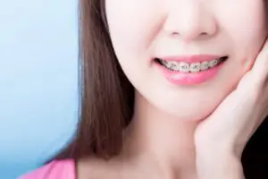 Woman closeup with braces