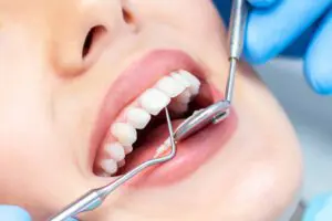 Orthodontic Treatment