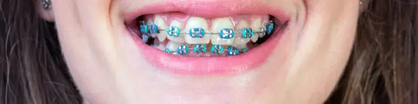 Prevent Oral Health Issues