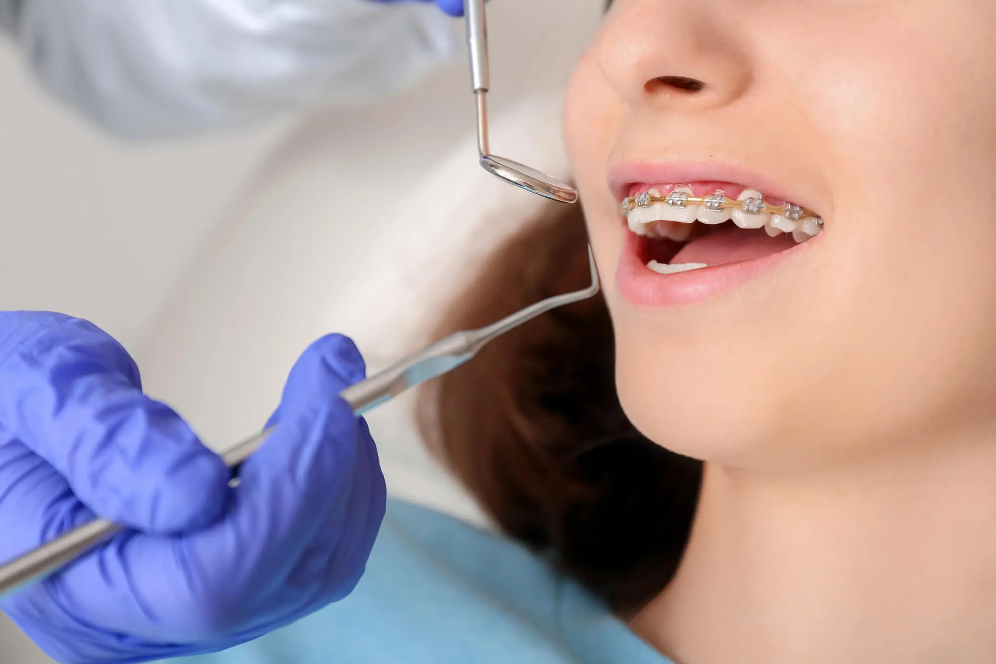 Teenage girl with dental braces visiting orthodontist in clinic