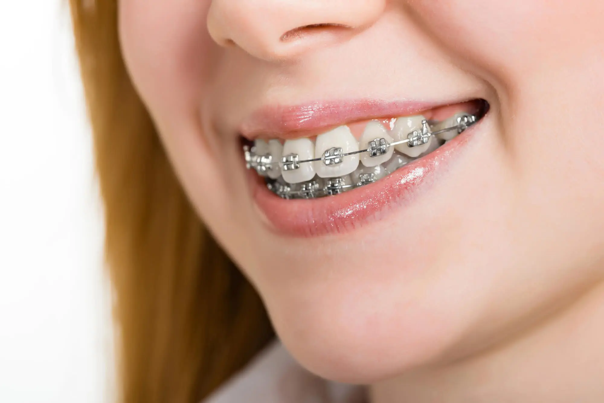 Young Woman with braces