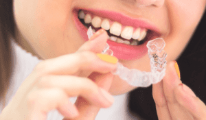 Woman wearing orthodontic silicone trainer