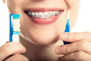 How to Whiten Teeth With Braces