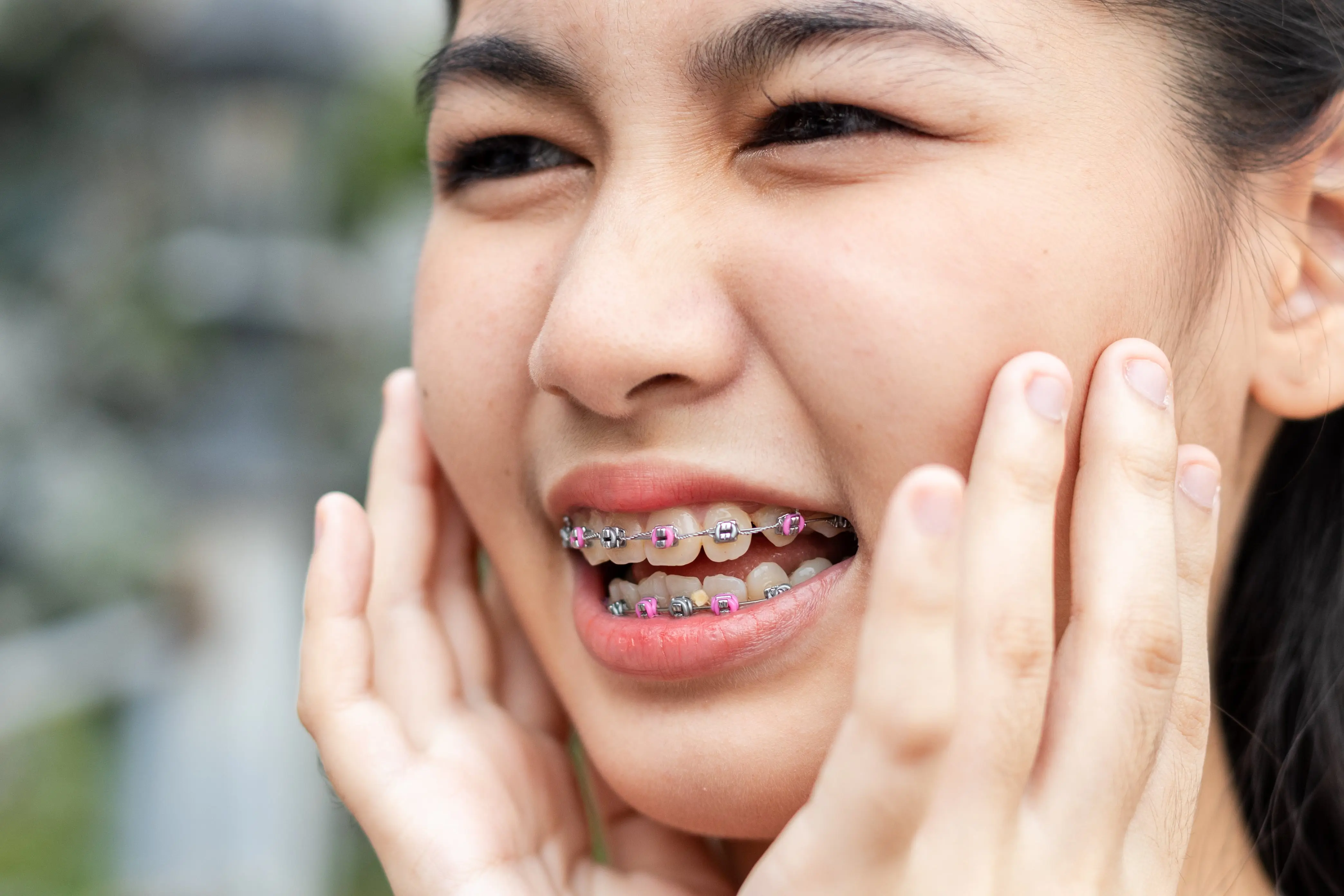 young woman holding her face with colored brand braces