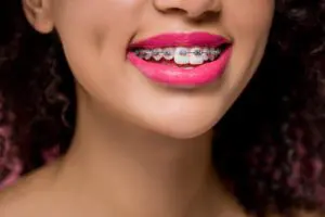 cropped view of smiling african american girl with dental braces and pink lips