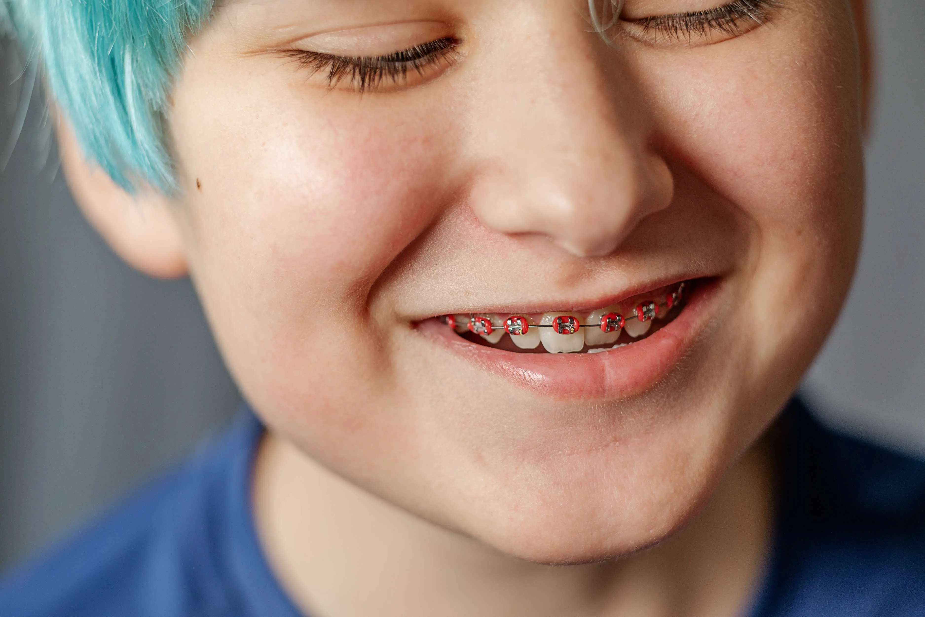 kid with colored hair with braces