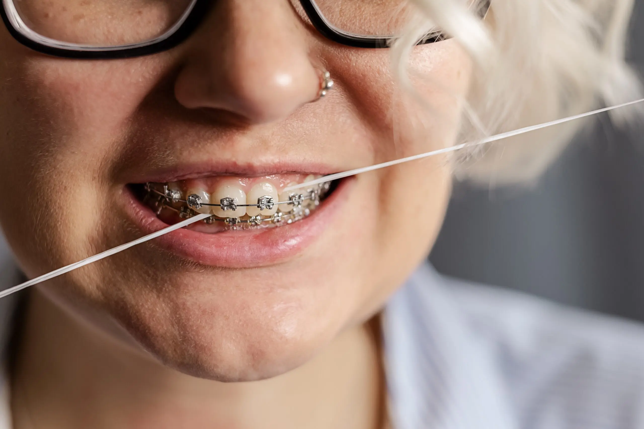 a-young-woman-with-braces-brushes-her-teeth-with-d-2023-11-27-04-51-44-utc