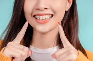 dental-beautiful-smiling-of-young-asian-woman-with-2023-11-27-04-57-18-utc