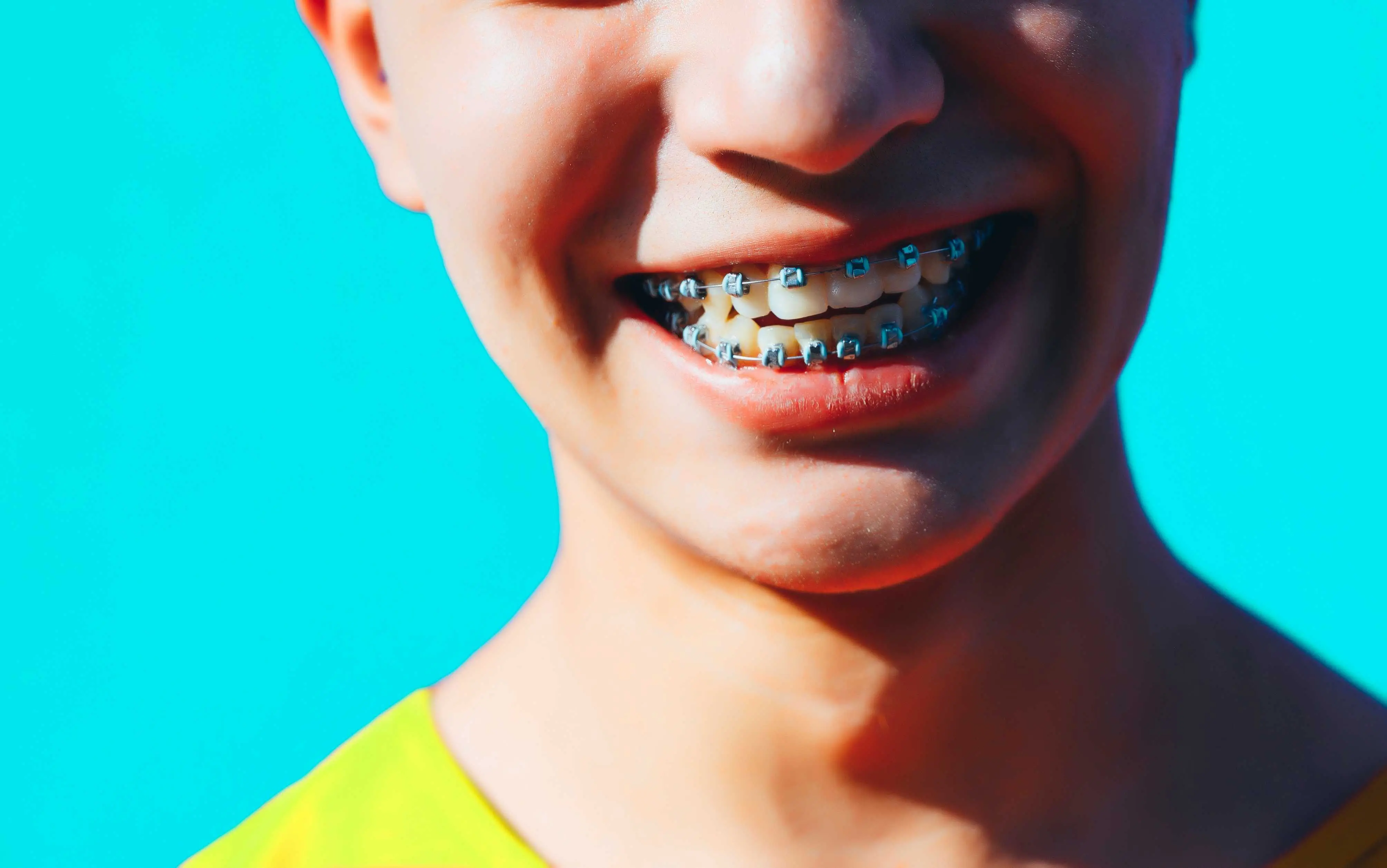 young man with colored braces band