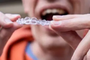 man holding clear aligners