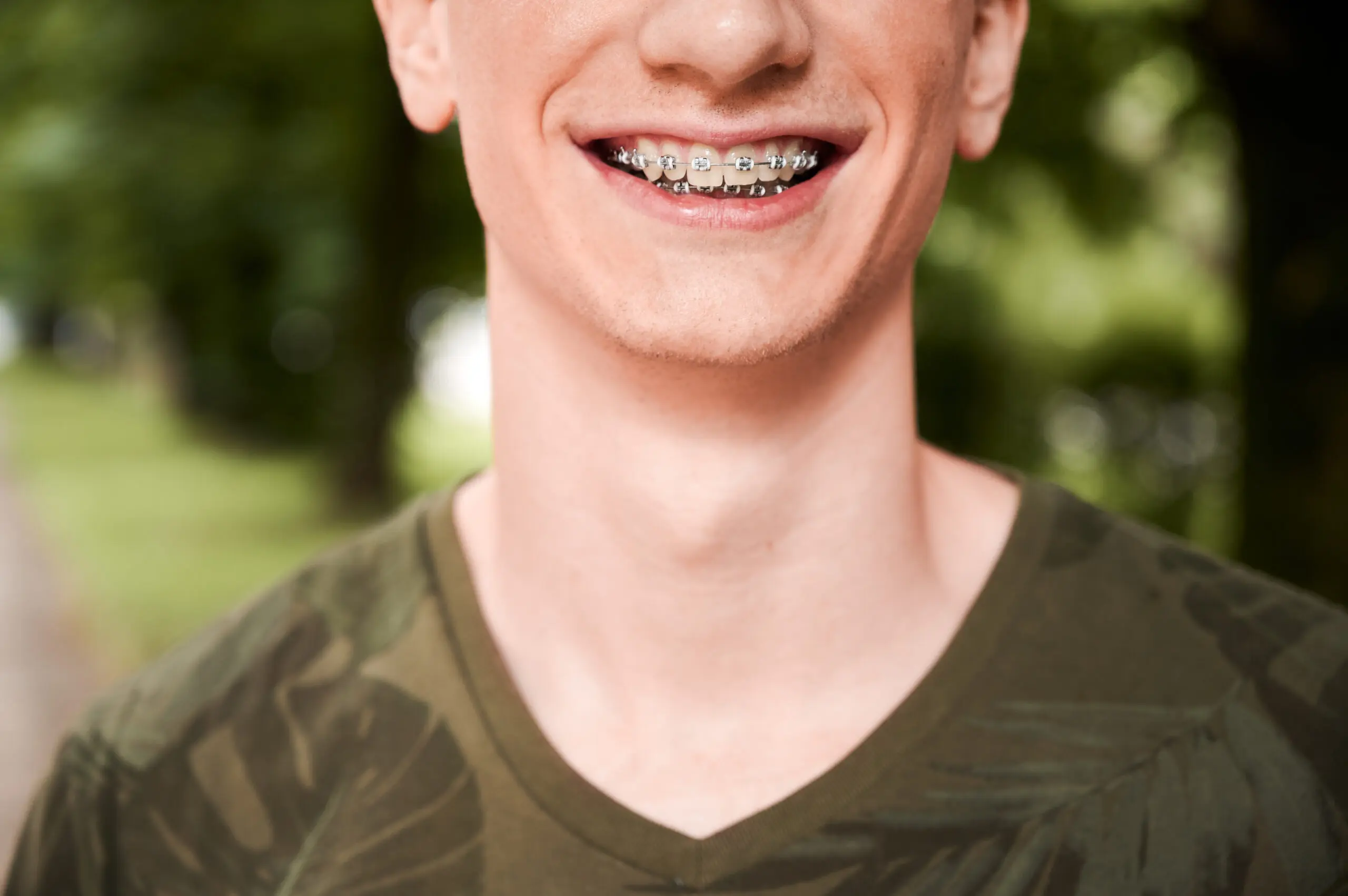 Close up of cheerful man with orthodontic brackets on teeth standing on the street. Joyful male patient demonstrating results of dental braces treatment. Concept of dentistry and orthodontics.