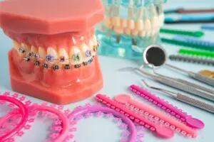 Orthodontic ligatures rings and ties, elastic rubber bands on orthodontic braces, model