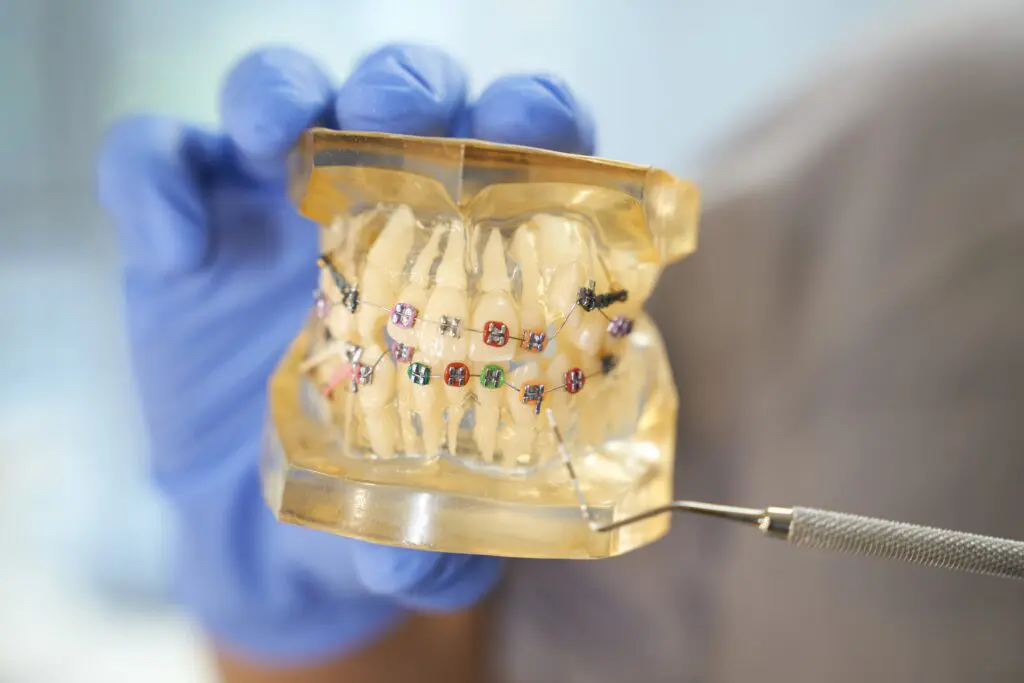 Dental model with braces and multicolored elastic bands