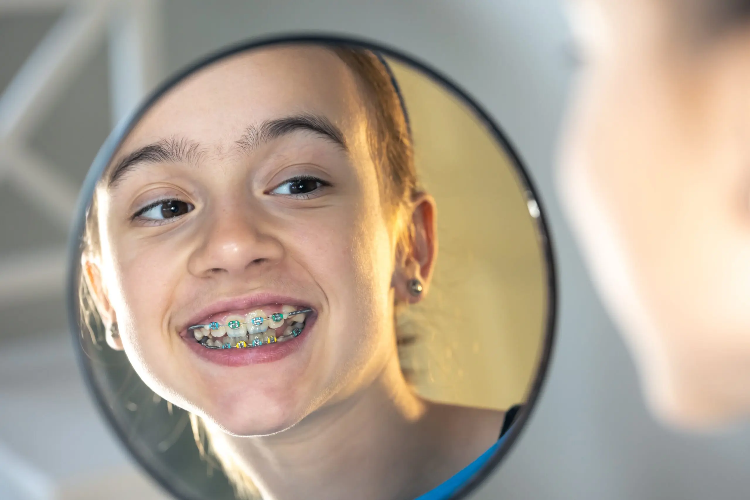 caucasian-preteen-girl-with-braces-on-her-teeth-lo-2025-03-15-07-05-21-utc-min