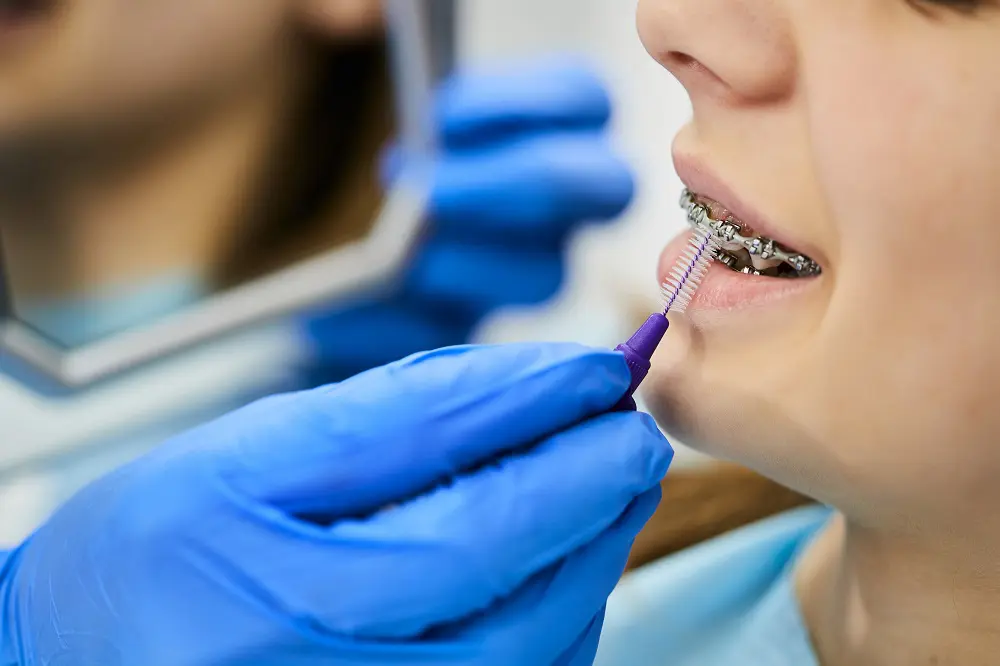 Close-up of orthodontist cleaning girl's dental braces with interdental brush at dentist's office.