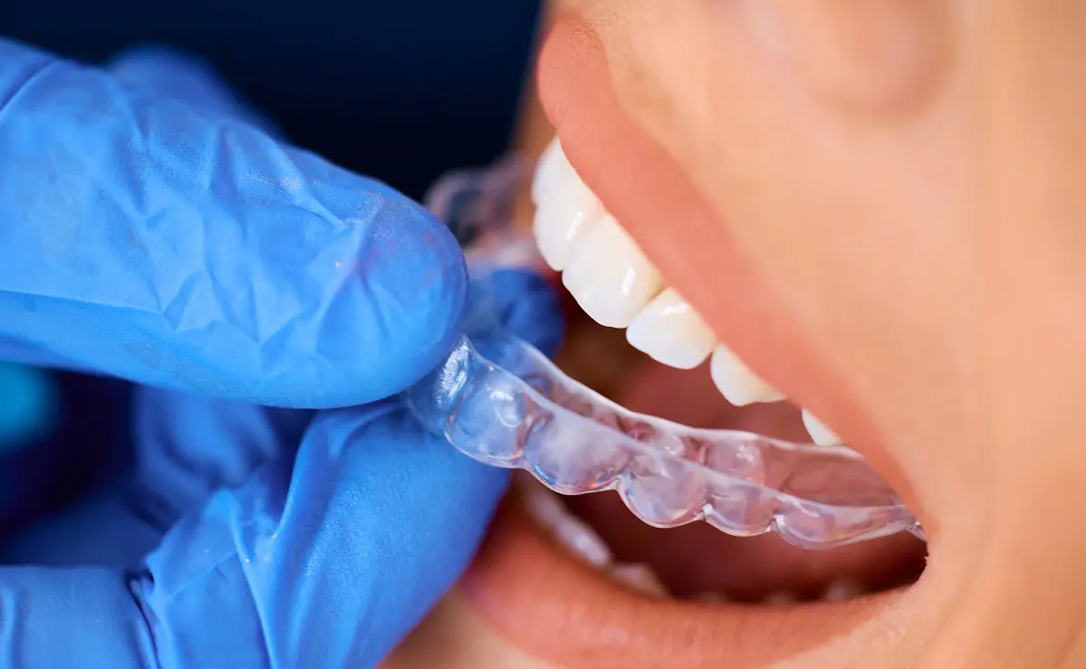 Close up of woman receiving transparent braces on her teeth at dentist's office,