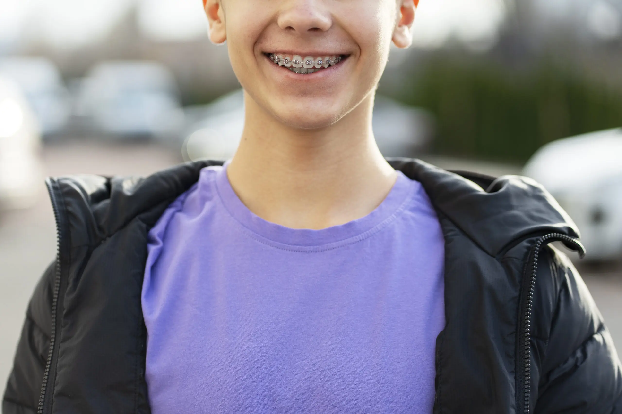 Portrait of smiling handsome boy with braces wearing stylish casual outfit posing on urban street in city, closeup. Health care, dental concept