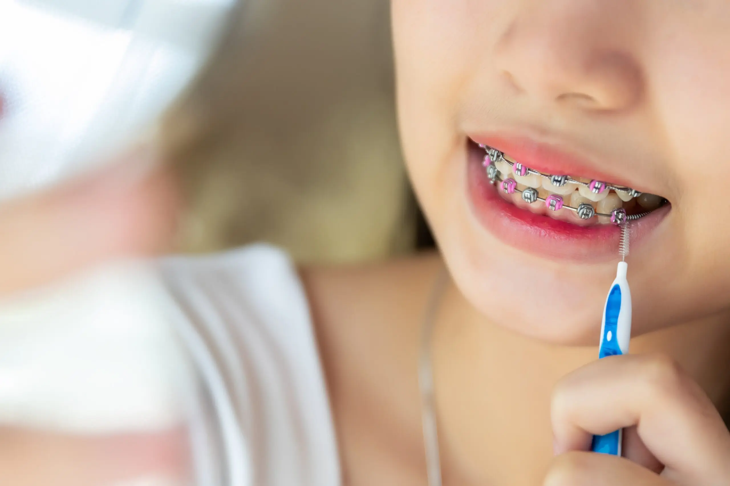 braces-teeth-girl-using-brush-cleaning