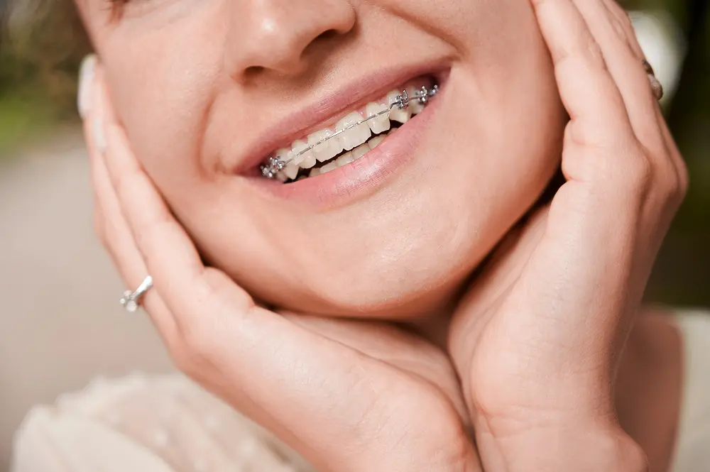 Close-up of a smiling person with braces on their teeth, gently holding their face with both hands—showcasing confidence after getting braces in Santa Rosa.