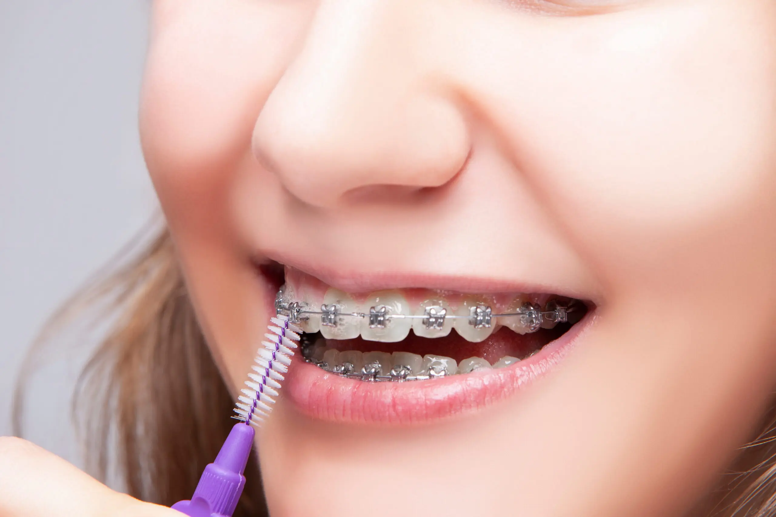 Girl cleaning metal braces using a small brush.