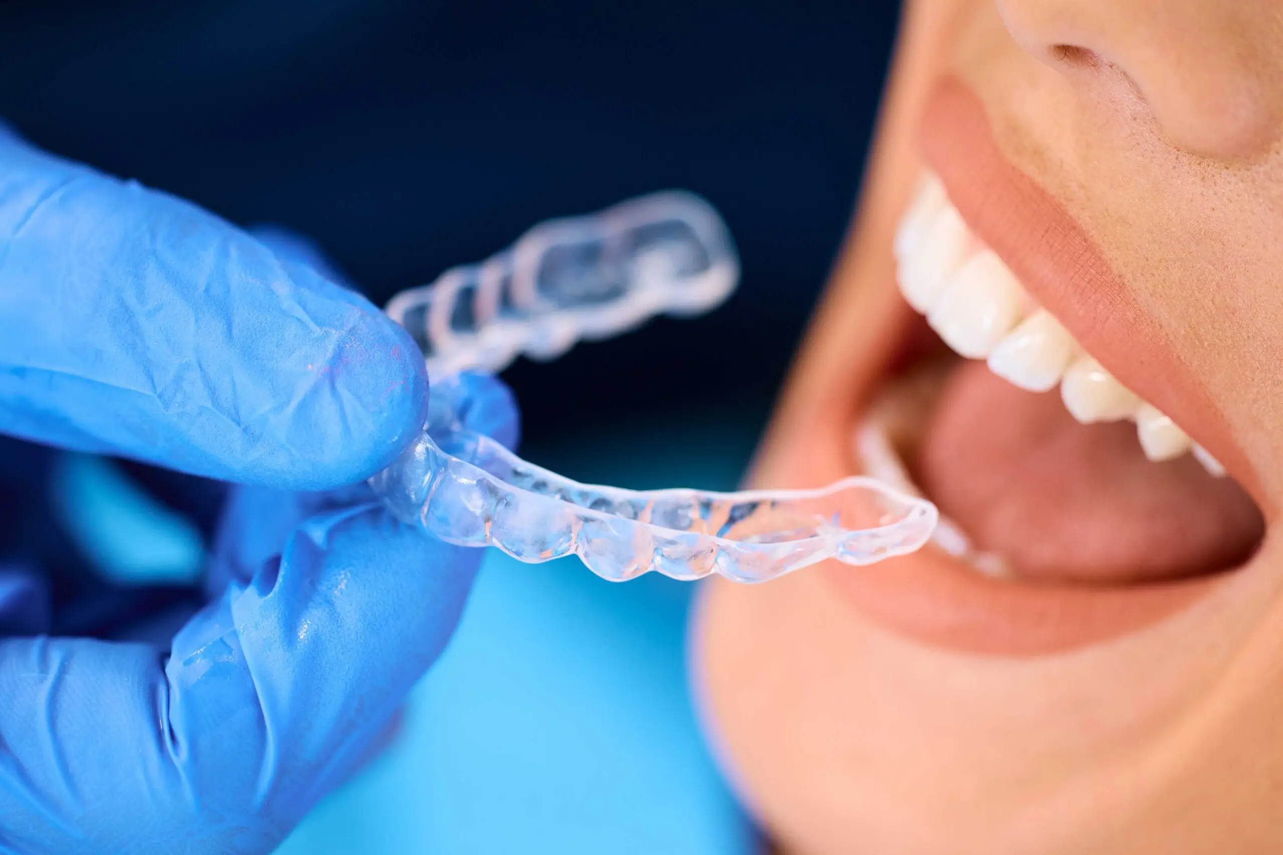 orthodontist putting a retainer to a patient
