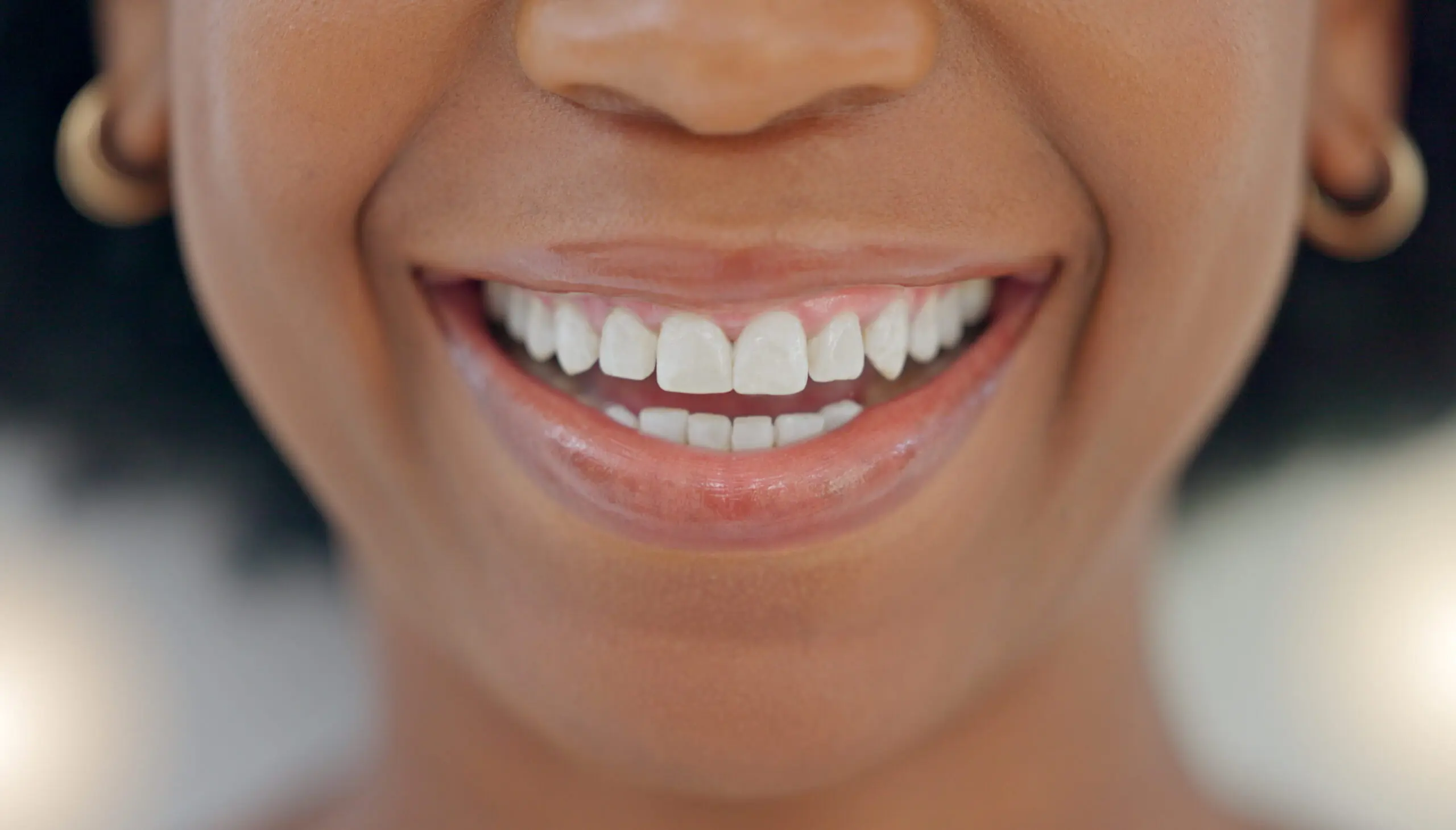 Girl smiling showing beautiful teeth.