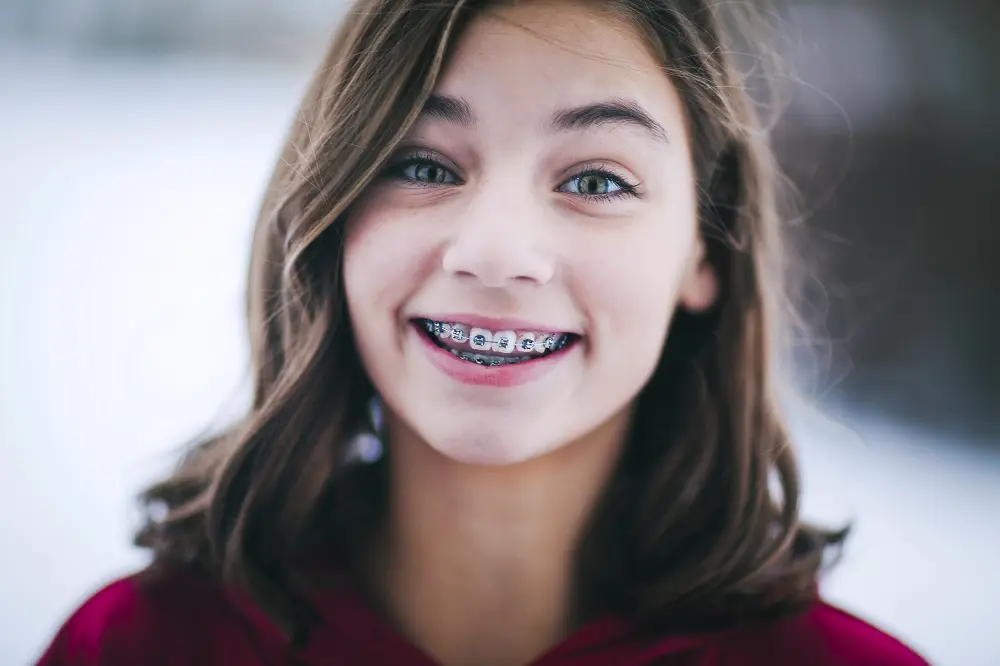 A girl with shoulder-length brown hair smiles, showing metal braces on her teeth. Wearing a red top and standing outdoors, she proudly displays her braces in Sacramento.