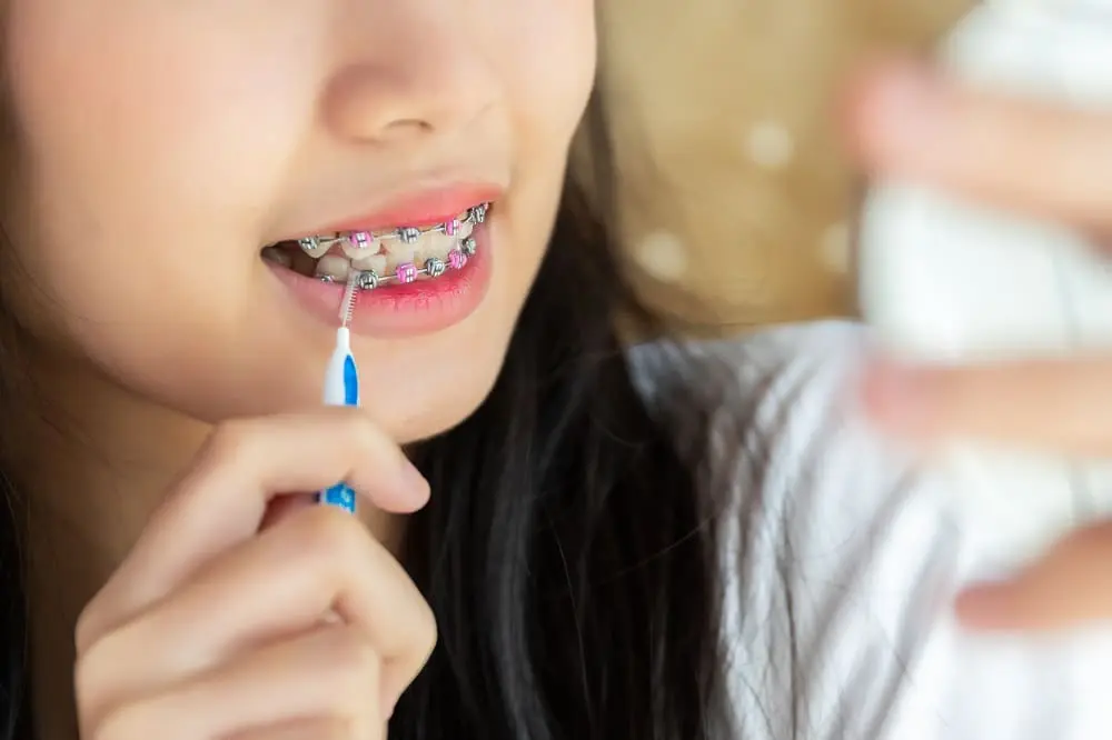 Close up braces teeth, Girl using brush cleaning braces. treatment health and cleaning teeth and mouth.