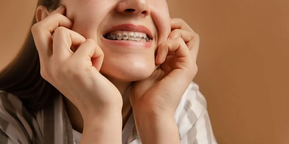 close up view braces. teenager girl show teeth on beige background