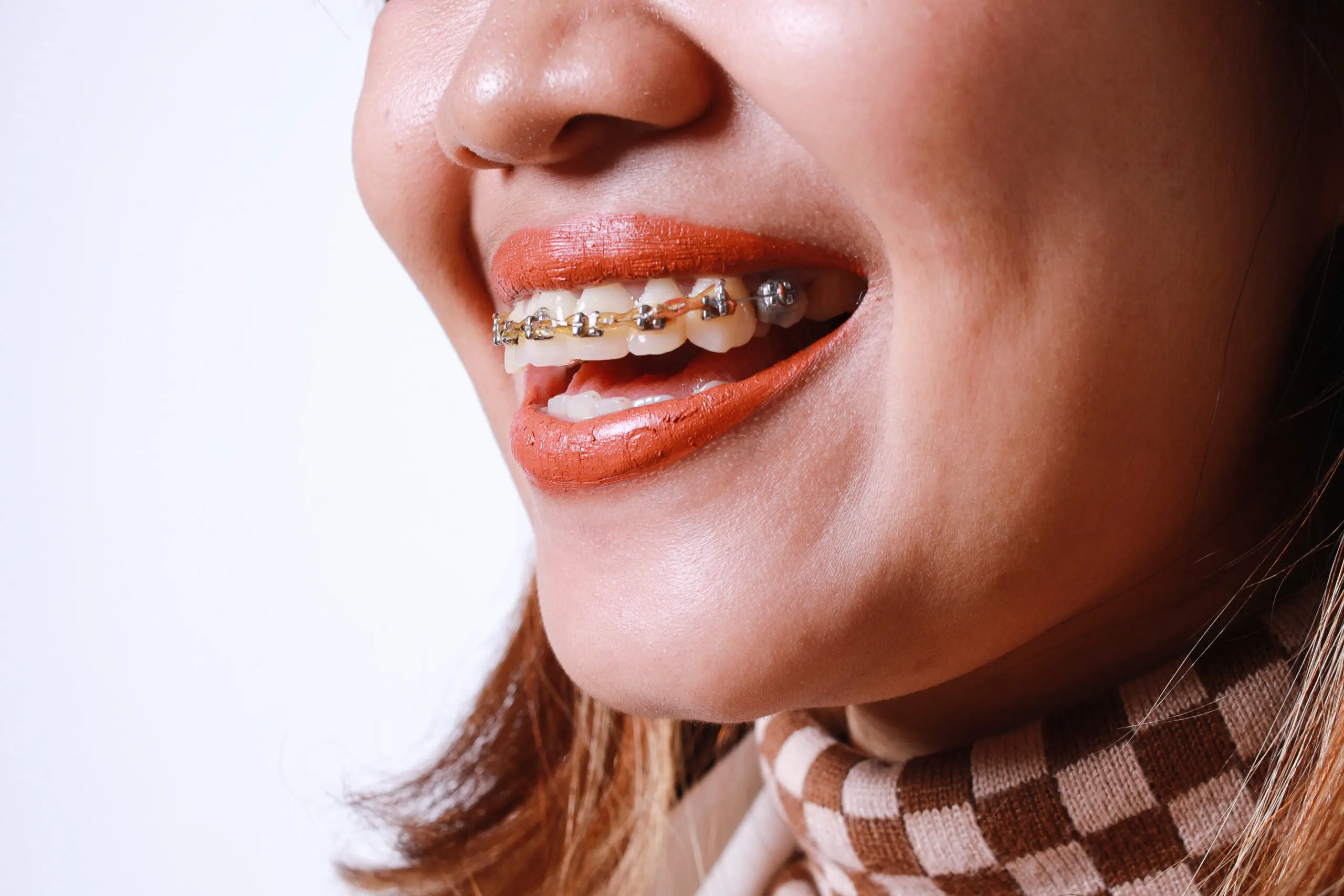 close-up-of-smiling-woman-with-braces-2026-01-09-07-15-22-utc
