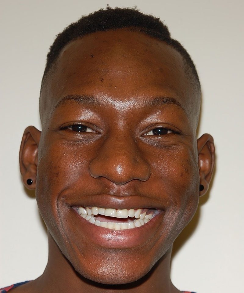 A black man smiling - Smilebliss