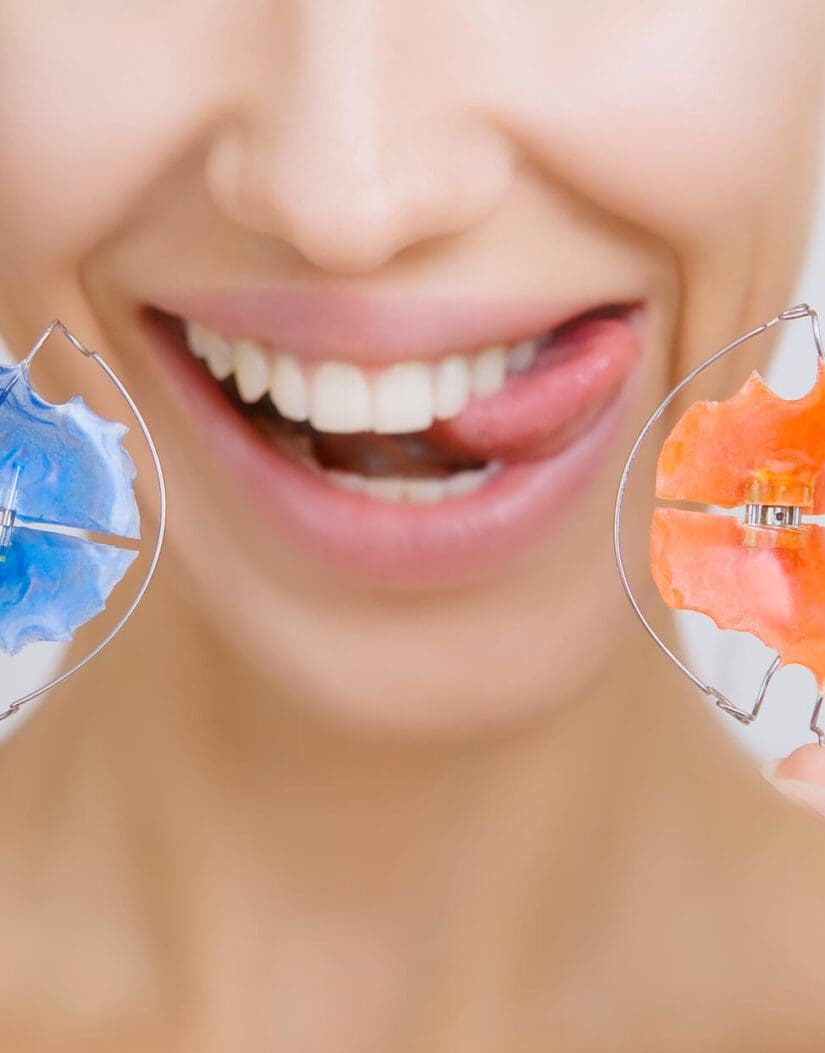 Girl with Retainer for Teeth sticking her Tongue out - Smilebliss Orthodontics