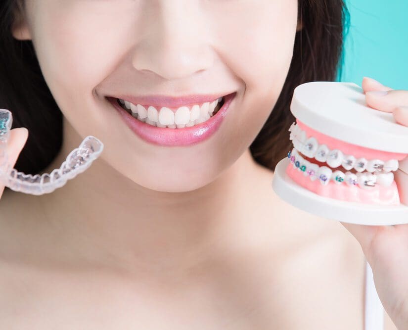 healthy dental concept
