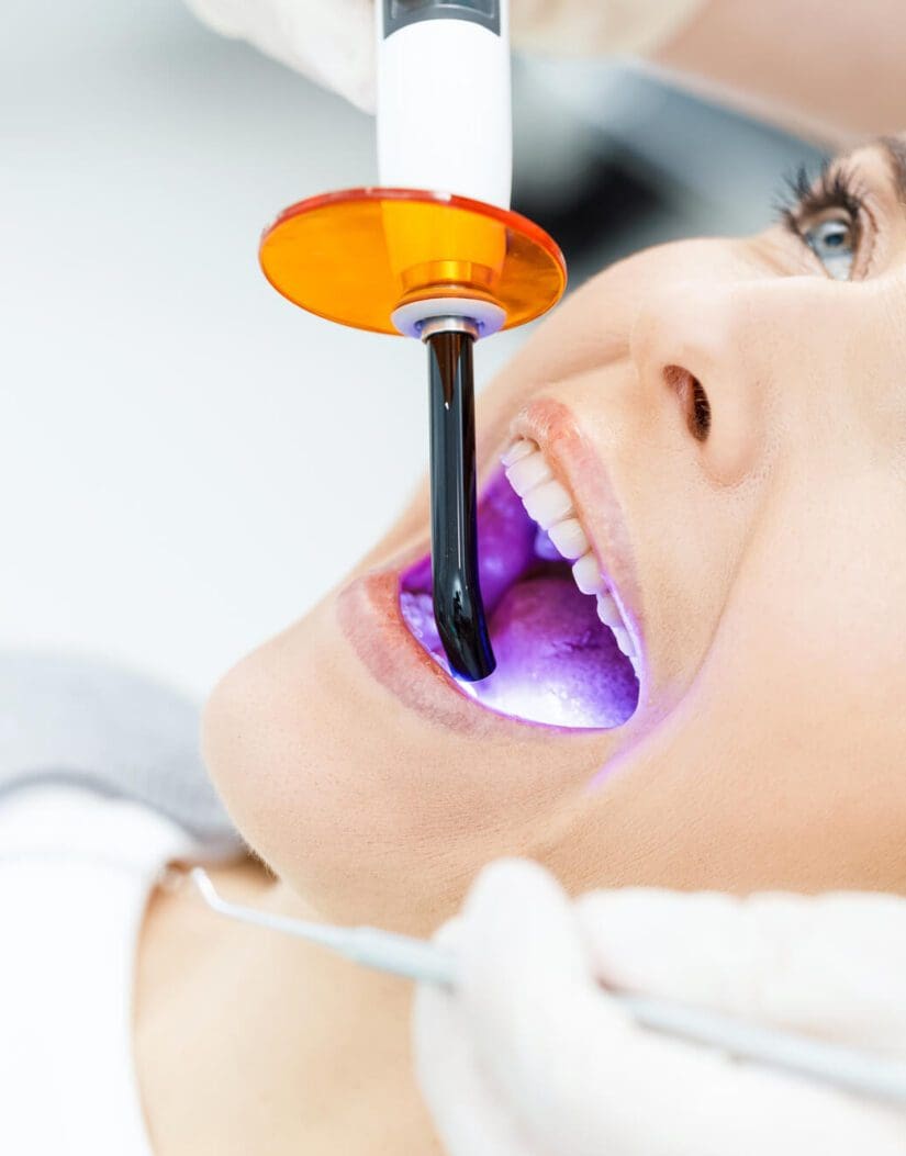 Dentist Teeth Whitening of Patient