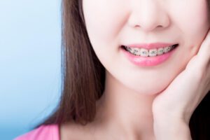 Woman closeup with braces