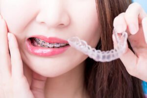 Woman wearing braces for your health concept- Smilebliss