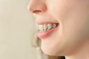 Oral Health Benefits of Bite Correction