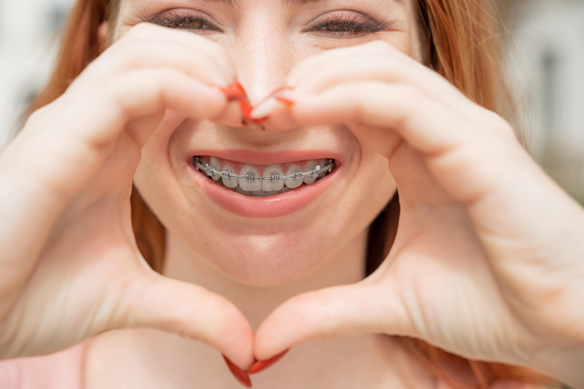 red haired woman smiling with braces making heart shape