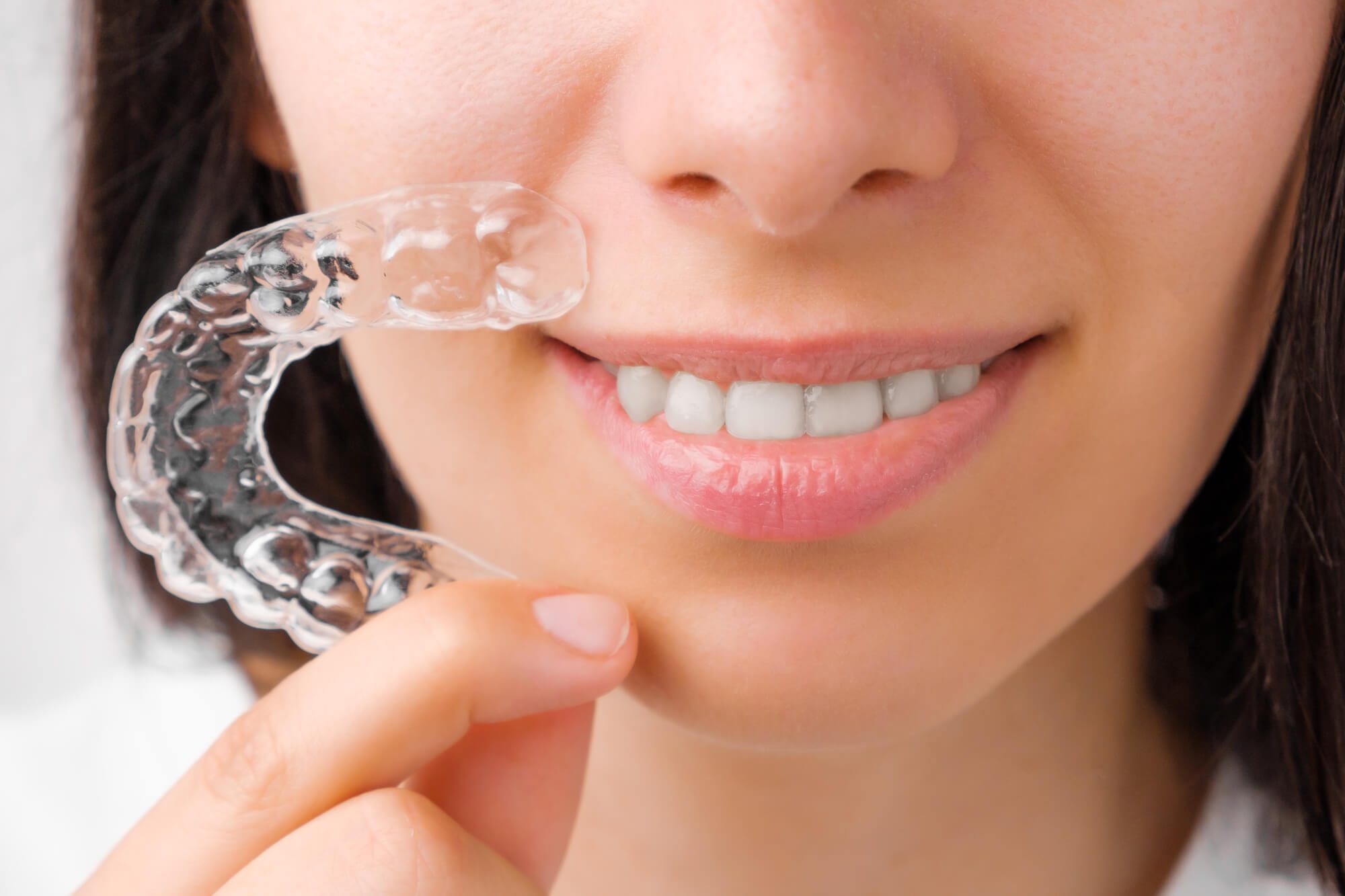 young woman holding aligners
