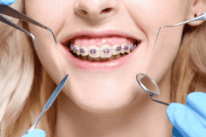 Orthodontic Solutions