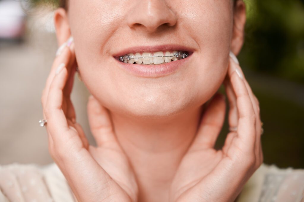 Close up of cheerful young woman with orthodontic brackets on teeth smiling. Patient demonstrating results of dental braces treatment. Concept of dentistry, stomatology and orthodontic treatment.