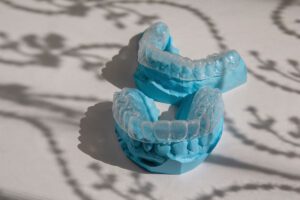 Pair of teeth aligners on a blue molded gum