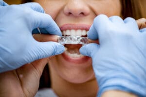 Close-up of dentist showing to the female patient how to use mobile orthodontic appliance for dental correction.