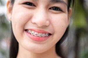 Portrait of a young asian woman with braces on her teeth