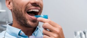 cropped view of bearded man putting retainer in mouth