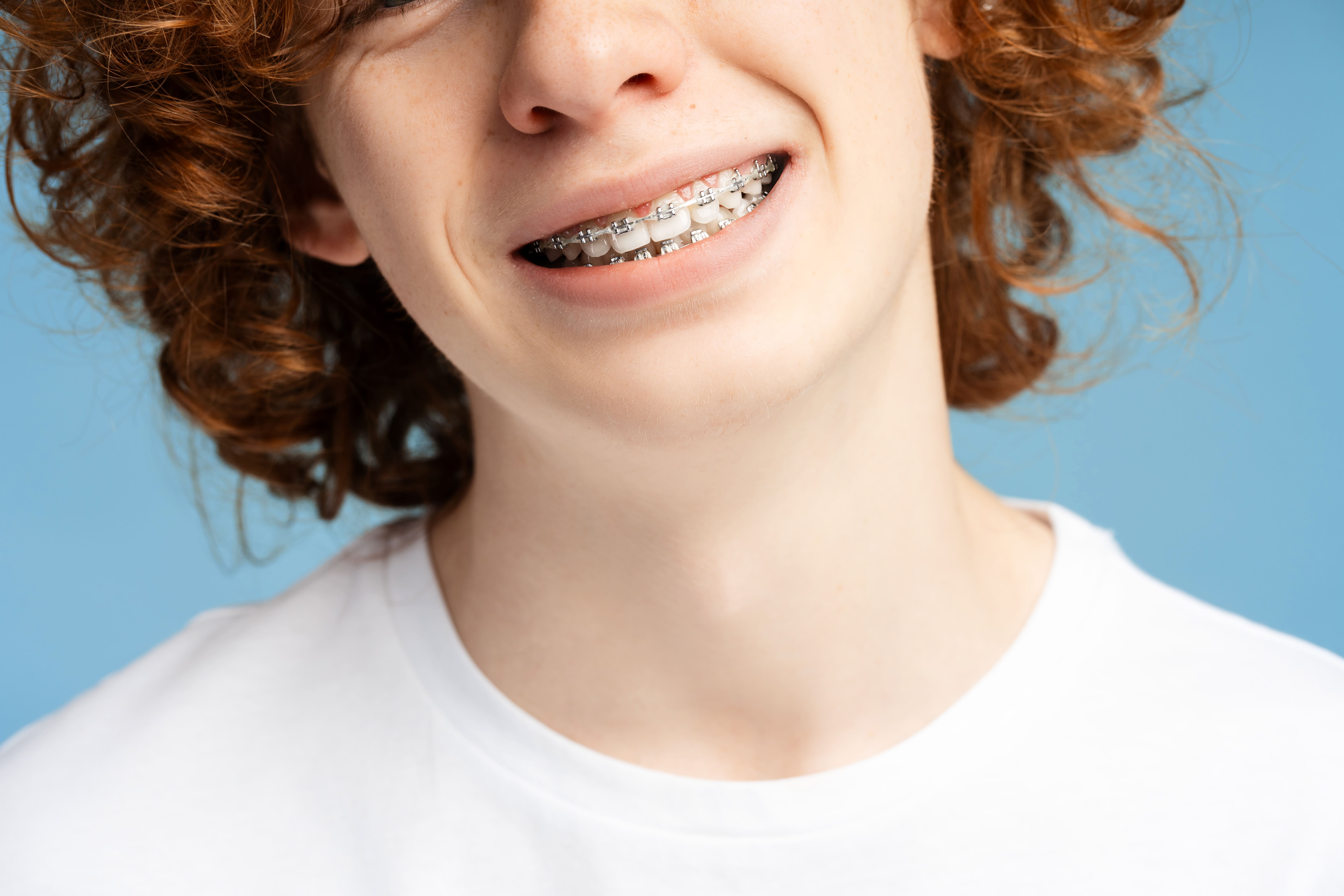 Closeup portrait of a happy, curly red haired male teenager wearing a white t shirt, with a wide, braced smile, isolated on a blue background. Dental wellness concept