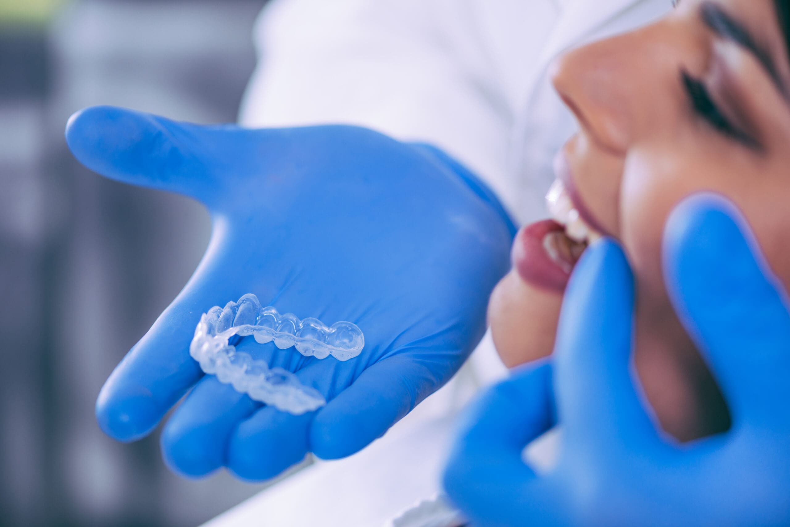 Clear Aligners for Gaps | Smilebliss